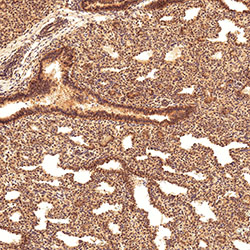 sars-cov-2 gene expression in a human fetus